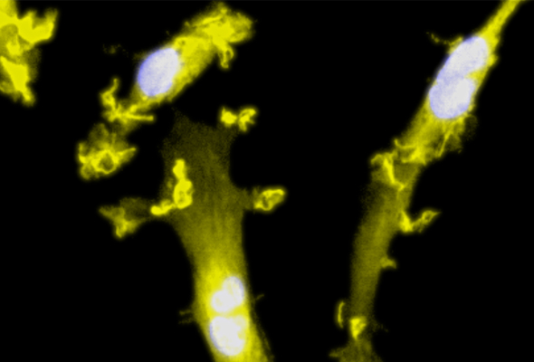 CRISPR-Ready ioMicroglia 이미지