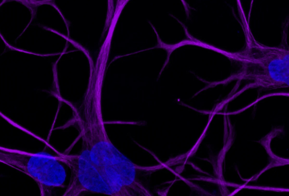 ioAstrocytes 이미지