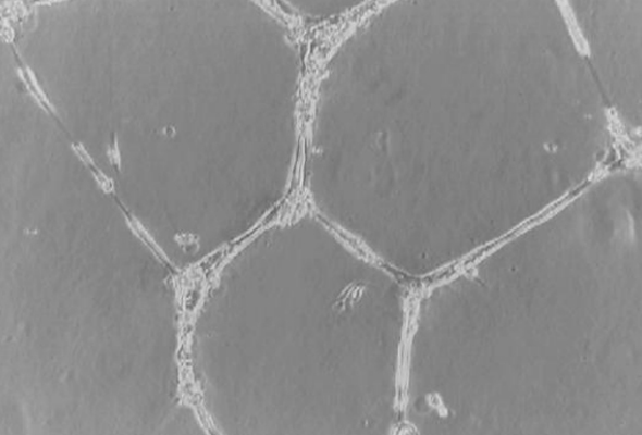 In Vitro Angiogenesis Assay | Endothelial Tube Formation Assay 이미지