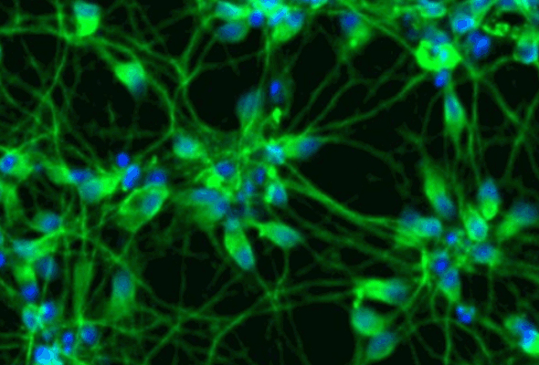 글루타메이트성 뉴런 | ioGlutamatergic Neurons 이미지