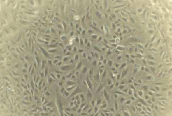 Human Umbilical Vein Endothelial Cells | HUVEC Cell 이미지