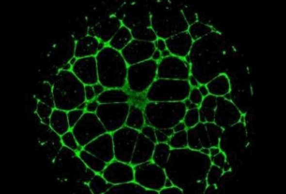 Angiogenesis Assay 서비스 | Tube Formation Assay Services 이미지