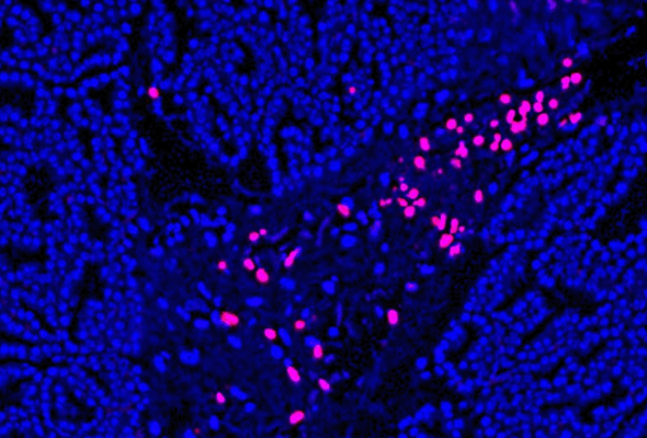 TUNEL Assay Apoptosis Detection Kit 이미지