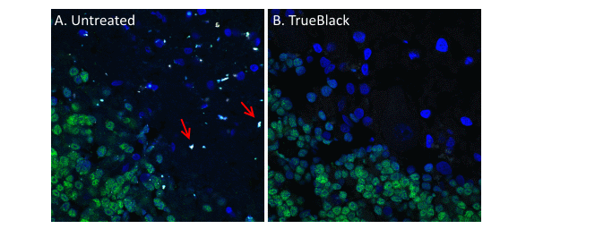 TrueBlack®-treatment-can-be-performed-before-or-after-immunofluorescence-staining