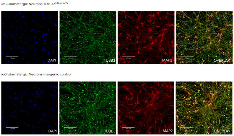koma-ALS_cells_pan_neuronal_markers