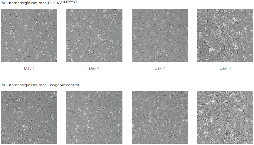 koma-ALS_cells_structural_network
