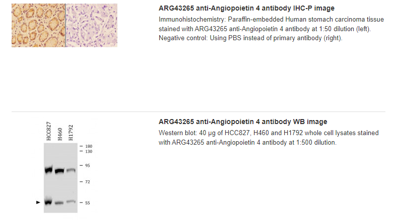 anti-Angiopoietin 4 antibody를 이용한 IHC, WB 실험결과