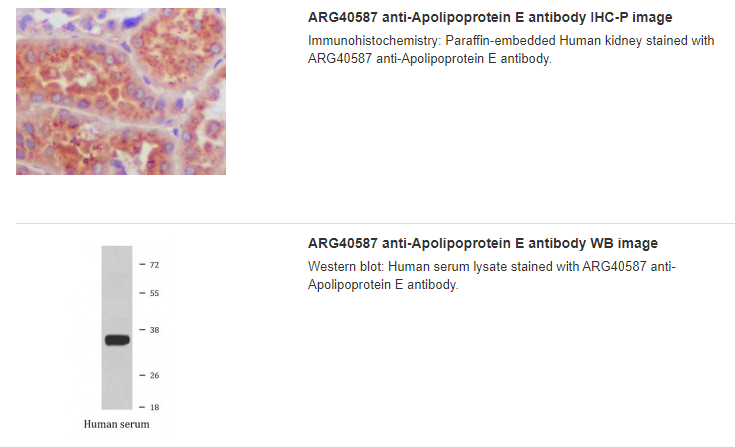 ARG40587 anti-Apolipoprotein E antibody IHC-P image