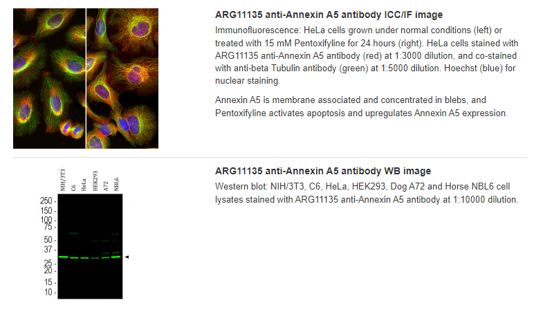 ARG11135 anti-Annexin A5 antibody ICC/IF image