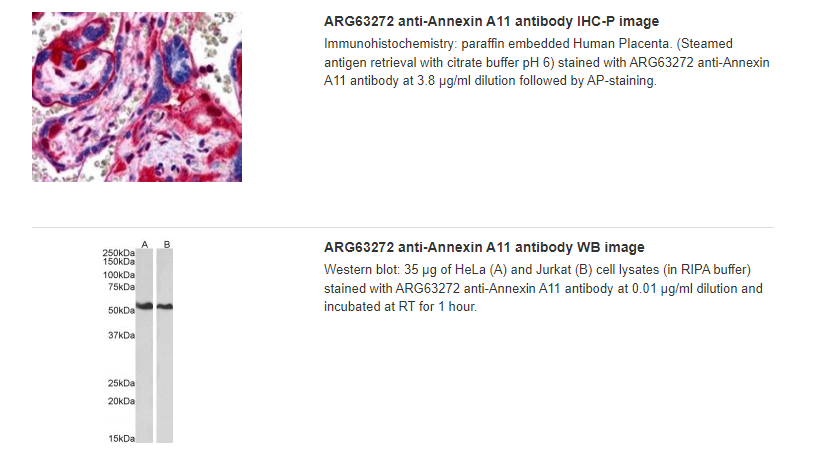 ARG63272 anti-Annexin A11 antibody IHC-P image