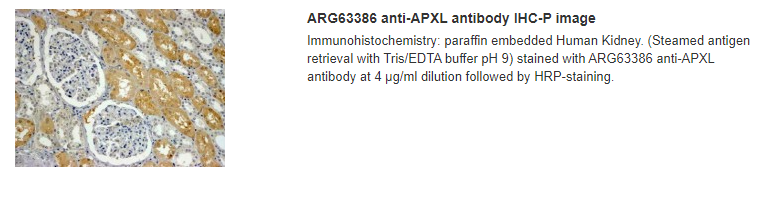 ARG63386 anti-APXL antibody IHC-P image
