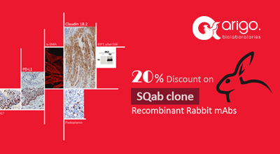 Rabbit monoclonal 항체 20% 이벤트 이미지