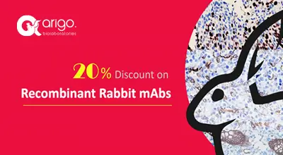 Recombinant Rabbit monoclonal antibody 제품 20% 할인 이미지